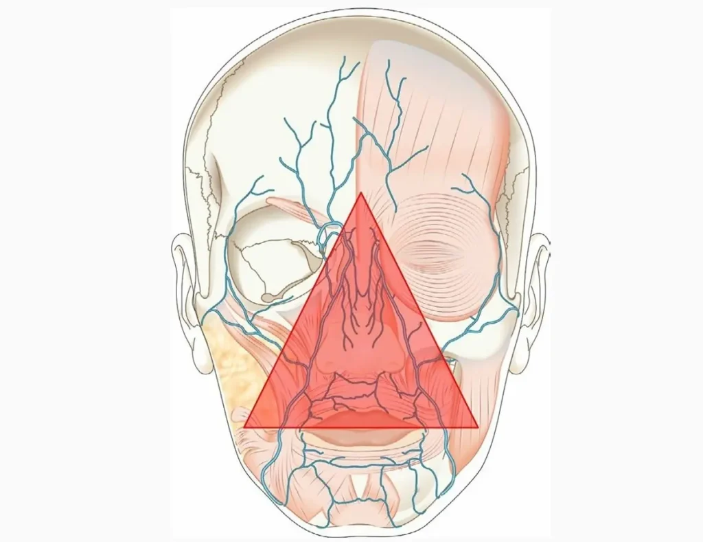 ترکاندن جوش زیر بینی می‌تواند به مغز آسیب برساند!